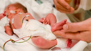Síndrome de Patau: o que é? Tire dúvidas sobre a condição!